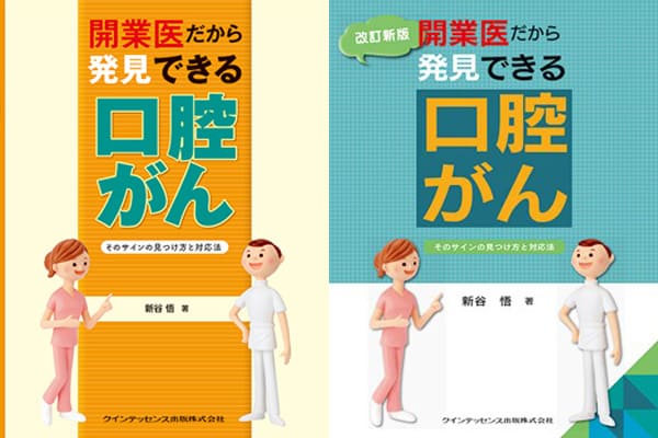 開業医だから発見できる口腔がん