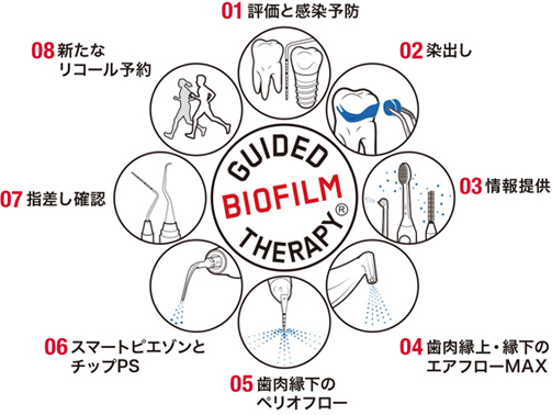 GBT（GUIDED BIOFILM THERAPY）