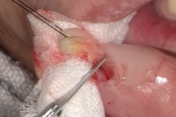 症例１（40歳代 女性）