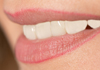 美容・審美歯科　歯を守る総合歯科治療